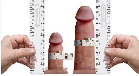 penis measurement for and after home augmentation