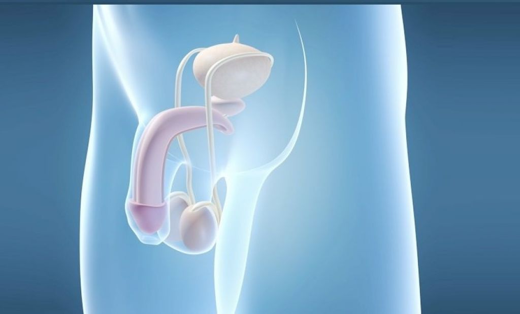 Prosthesis implantation is a surgical method to enlarge the male penis